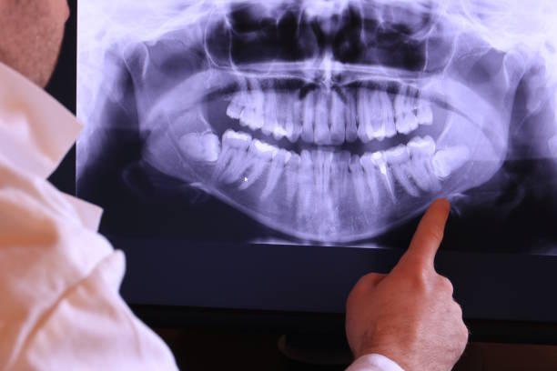 Best Emergency TMJ Treatment in Henderson, KY
