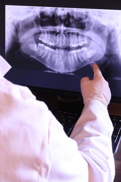 Best Emergency Wisdom Teeth Removal in Henderson, KY
