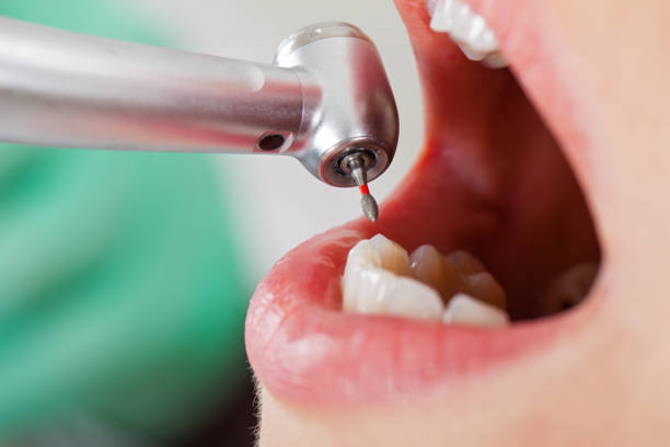 Best Emergency Gum Treatment in Henderson, KY